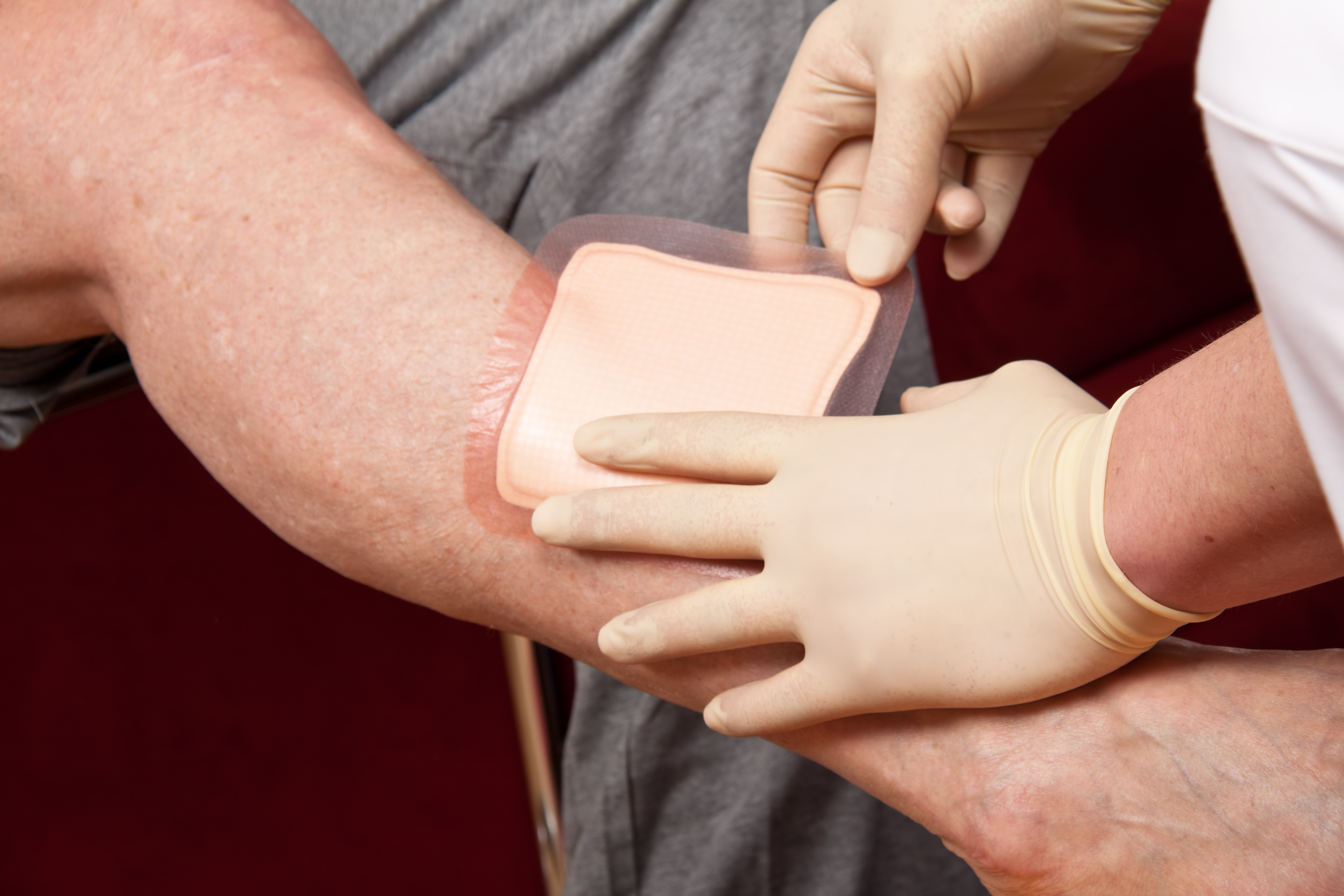 Borger får sat bandage på sit ben.