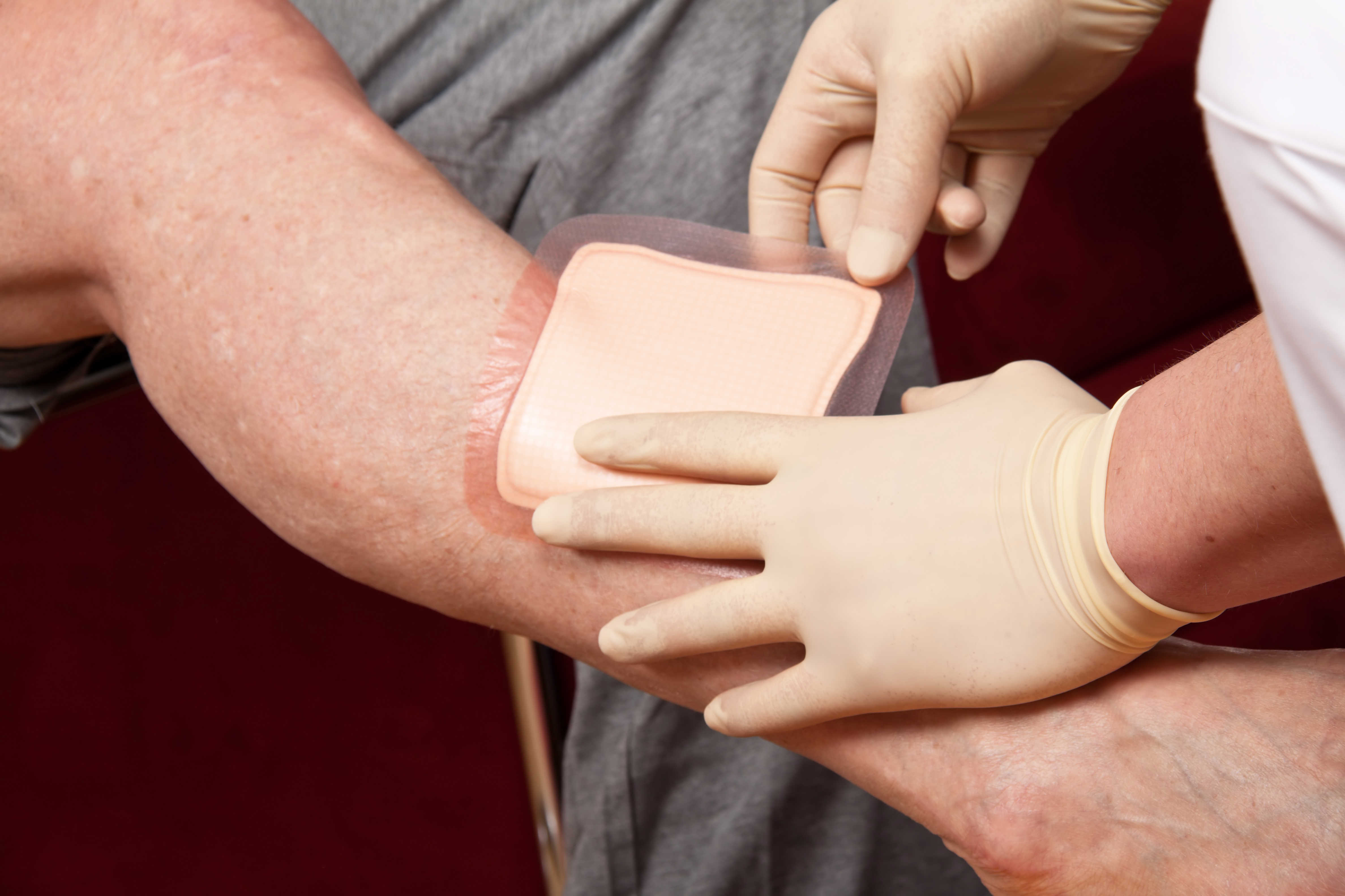 Borger får sat bandage på sit ben.